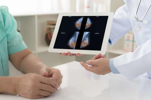 DESTINY-Breast04 Results are ‘Practice-Changing’