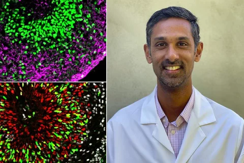 Ranmal and organoids