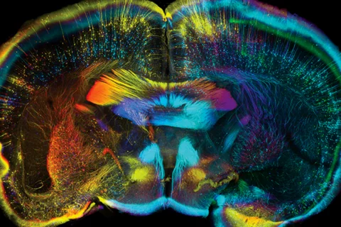 What Is a Psychiatrist? Composite of grey matter in the brain