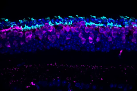 Cone photoreceptors in the degenerating retina