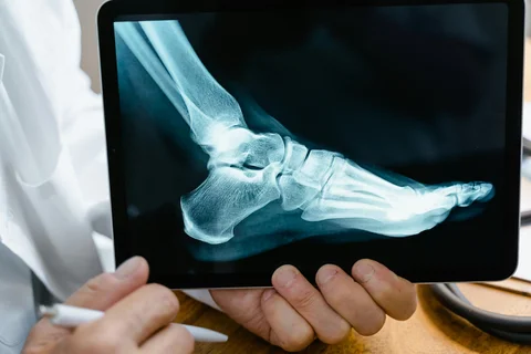Person Holding Black Tablet Computer with x-ray image of a foot