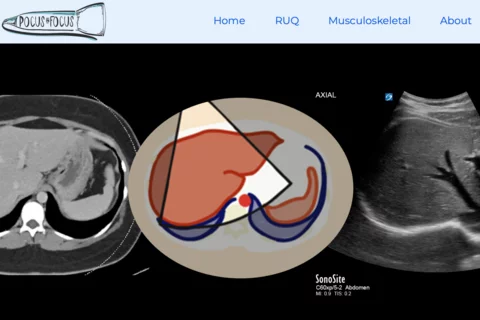 Screenshot of Pocus in Focus website
