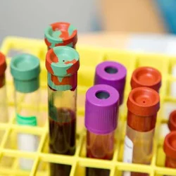 A new technology called PSMA might help identify men at risk