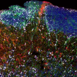 Fluorescent imaging of diverse cell types in a human brain section. (Oier Pastor-Alonso, UCSF)