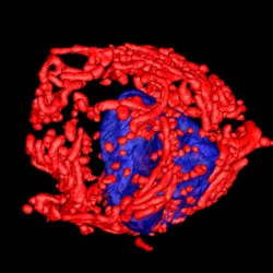 Cancer Cells Shackelford Lab