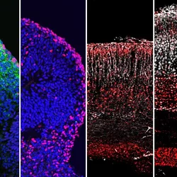 Cell With Zika Virus