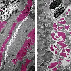 Heart muscle cells in mice