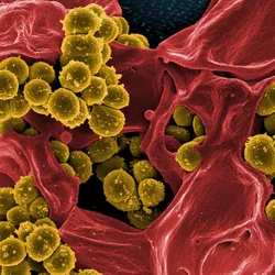 MRSA
