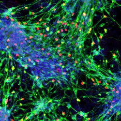 Sensory interneurons derived from mouse stem cells