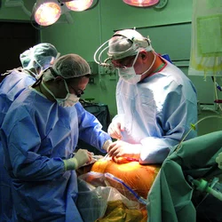 Doctors performing transplant