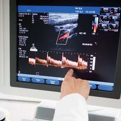 UCLA Health Cardiac Arrhythmia Center