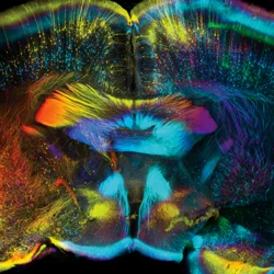 What Is a Psychiatrist? Composite of grey matter in the brain 