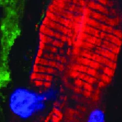 Immunofluorescent staining demonstrating fibroblasts expressing the Channelrhodopsin protein in heart scar tissue. The ChR2-expressing fibroblast (green, arrow) is in close proximity to cardiomyocytes (red) within scar.