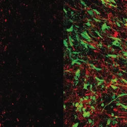 brain tissue