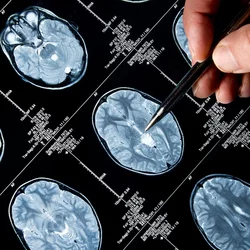 brain scan images