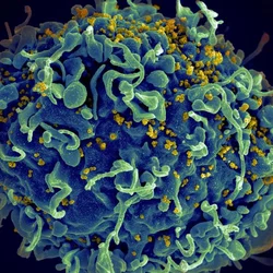 A human T cell, in blue, under attack by HIV, in yellow