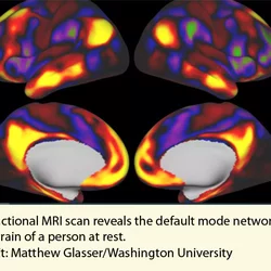 MRI scan