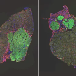 Regenerated mouse muscles transplanted with muscle stem cells 