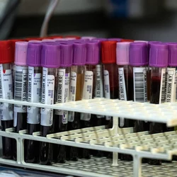 Hematology imagery - blood platelet samples 